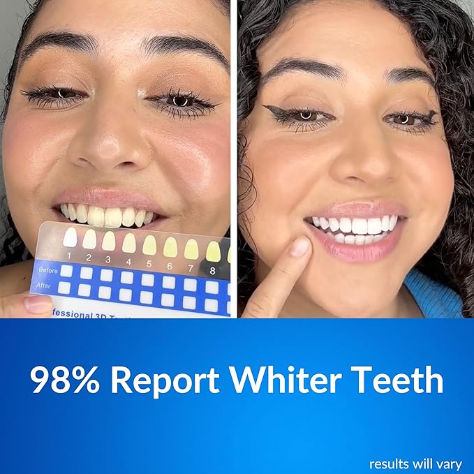 Polar MD Teeth Whitening Kit, Professional Teeth Whitener Gel Pens, 1YR. Supply, Compare to Whitening Strips. Powerful 32 LED Wireless Activating Light.-Ruum Studio Home