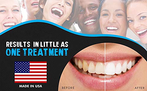 Bright White Smiles 44% Teeth Whitening Gel Syringe Refill Pack, Carbamide Peroxide, 5 Syringes (3ml),Tooth Whitener Formula-Ruum Studio Home