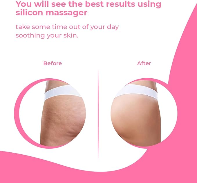 Anti Cellulite Massager Roller - Anticellulite Fascia Blaster for Cellulite Remover - Improves Blood Flow Use Cellulite Brush & Cellulite Roller with Cream or Oil for Cellulite Treatment-Ruum Studio Home