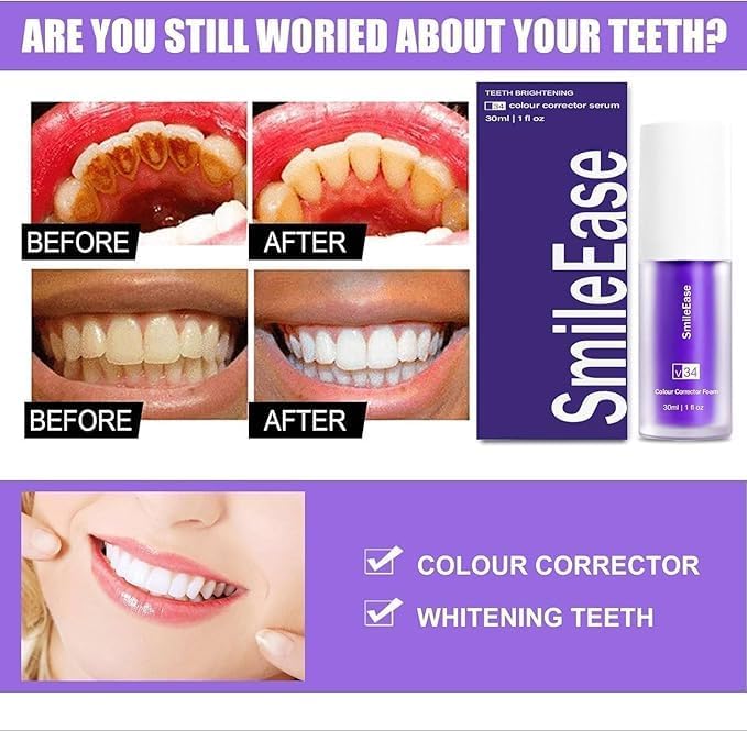 Purple Toothpaste for Teeth Whitening, Purple Whitening Toothpaste for Adults,Tooth Stain Remover Gel - Tooth Whitener Suitable for Smoking, Coffee, and Removing Dental Stone ﻿(2fl oz/60ml)-Ruum Studio Home