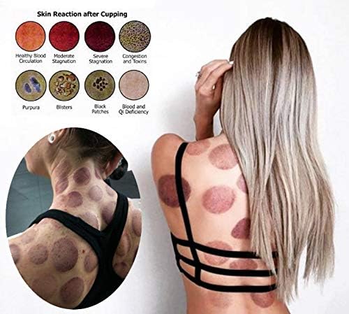 MUCHOO Cupping Set Professional Chinese Acupoint Cupping Therapy Sets Portable, Suction Hijama Cupping Set with Vacuum Magnetic Pump Cellulite Cupping Massage Kit 22-Cup-Ruum Studio Home