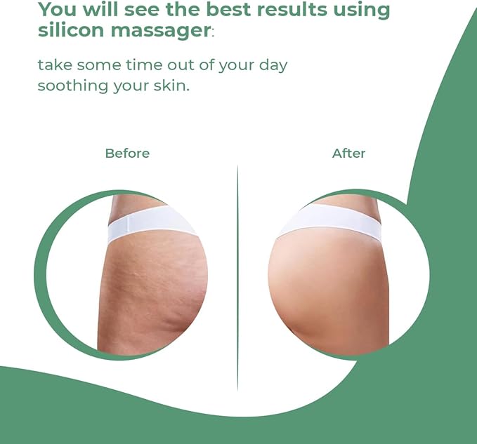 Anti Cellulite Massager Roller - Anticellulite Fascia Blaster for Cellulite Remover - Improves Blood Flow Use Cellulite Brush & Cellulite Roller with Cream or Oil for Cellulite Treatment-Ruum Studio Home