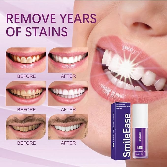 Purple Toothpaste for Teeth Whitening, Purple Whitening Toothpaste for Adults,Tooth Stain Remover Gel - Tooth Whitener Suitable for Smoking, Coffee, and Removing Dental Stone ﻿(2fl oz/60ml)-Ruum Studio Home