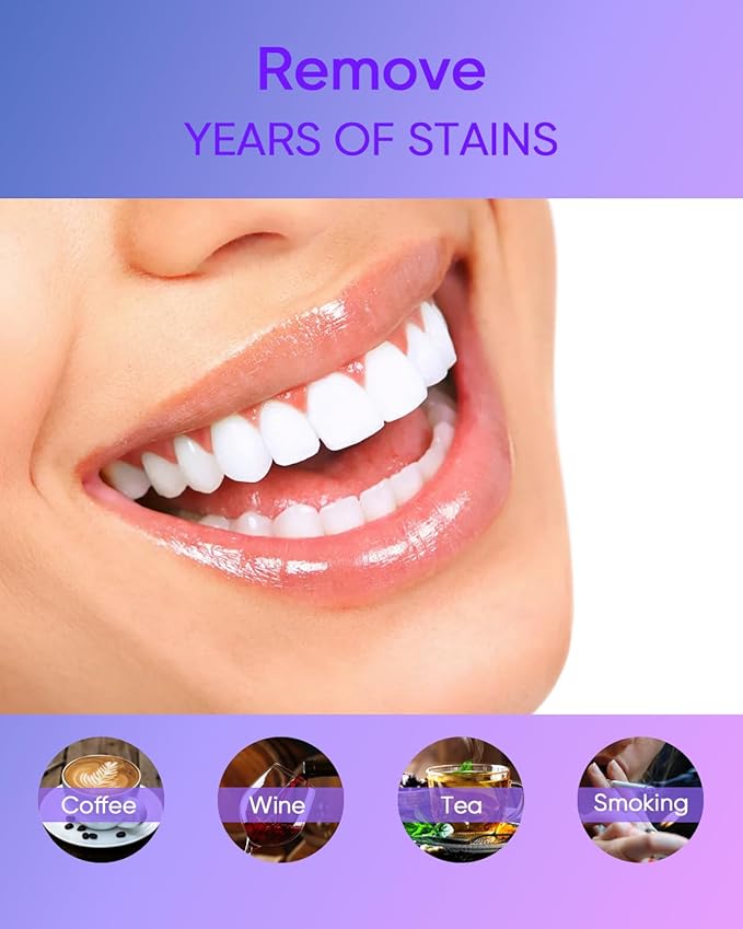 MySmile 4Pcs 35% Non-Sensitive Teeth Whitening Gel Refill Pack Kit for Whitening Teeth - Effective Painless Carbamide Peroxide Enamel Safety Mint Flavor Teeth Whitener(Not Include LED Mouth Tray)-Ruum Studio Home