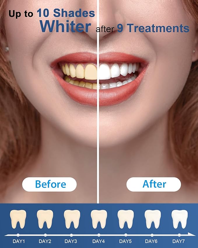 MySmile Teeth Whitening Gel Refills Pack, 6 Non-Sensitive Teeth Whitening Gel Pen, Teeth Whitener Dental Grade Tooth Whitening Gel for Tray, 10 min Fast Result Whitening-Ruum Studio Home