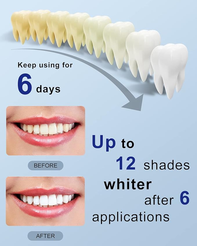 MySmile Teeth Whitening Strips Kit 14 Treatments with 28 LED Light - 10 Min Non-Sensitive Fast Whitening Teeth Enamel Safe Teeth Whitener - Helps to Remove Deep Stains-Ruum Studio Home