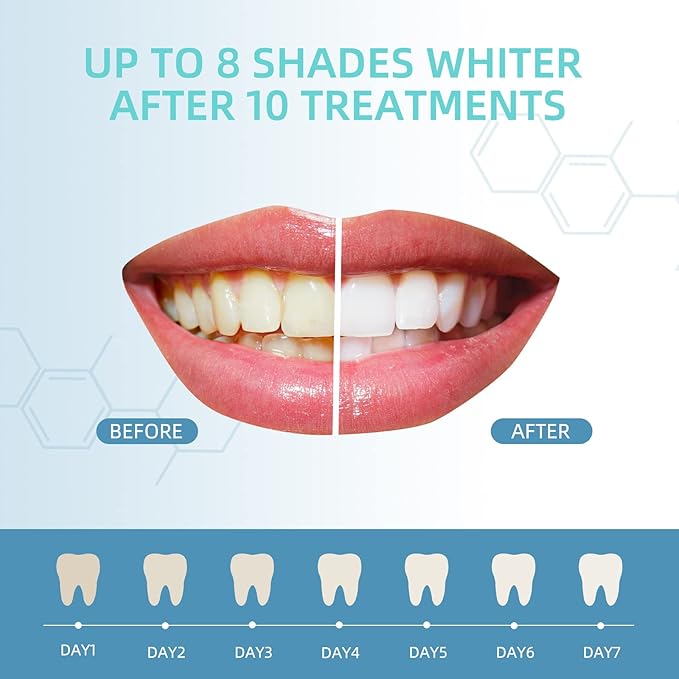 Teeth Whitening Gel Refills 10PCS Tooth Whitener 48+ Treatments -Removes Years of Stains 35% Carbamide Peroxide-Ruum Studio Home