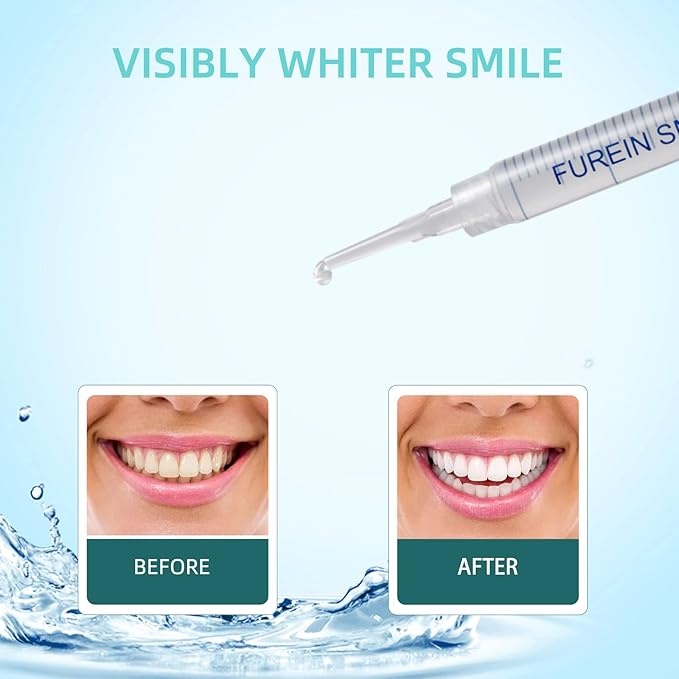 Teeth Whitening Gel Refills 10PCS Tooth Whitener 48+ Treatments -Removes Years of Stains 35% Carbamide Peroxide-Ruum Studio Home
