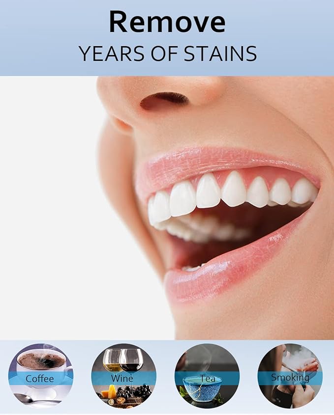 MySmile Teeth Whitening Gel Pen Refill Pack, 3 Non-Sensitive Teeth Whitening Pen, Deluxe Teeth Whitener Dental Grade Tooth Whitening Gel with Carbamide Peroxide for Home, 10 min Fast Result-Ruum Studio Home