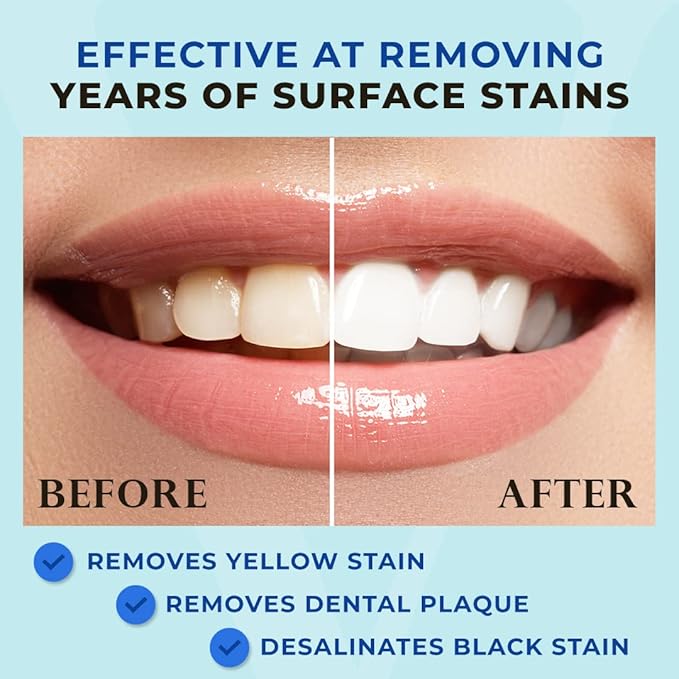 Venus Visage Award Winning Teeth Whitening Pen, 20+ Uses - Teeth whitening Kit Professionally formulated - Best Teeth whitening Gel Pen Teeth Whitener - Low Sensitivity (Mint) (0.07 Fl Oz (Pack of 2))-Ruum Studio Home
