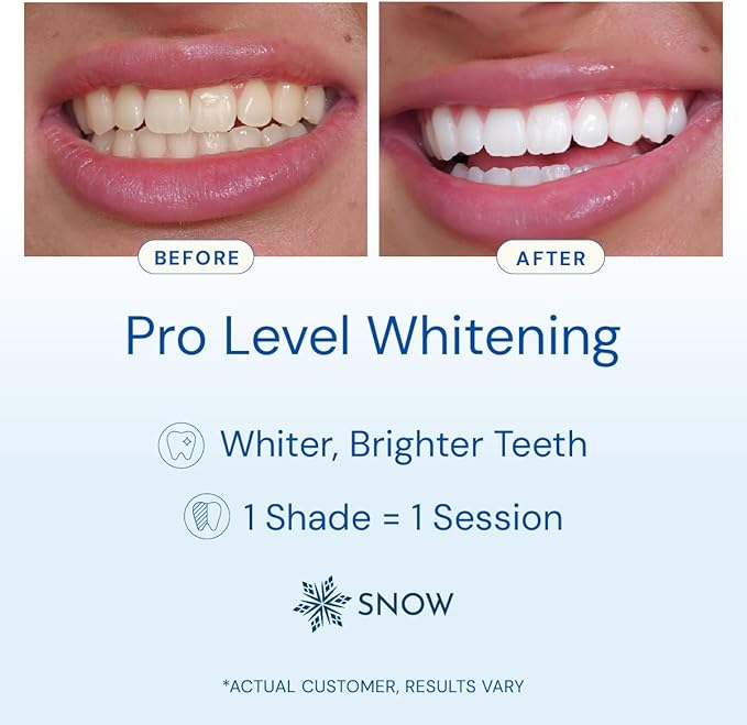 Snow Teeth Whitening Kit - Snow Teeth Whitening Serum and LED Mouthpiece Whitener, Formulated with Hydroxyapatite, Good for 6 Months - Wireless Kit with 3 Wands-Ruum Studio Home
