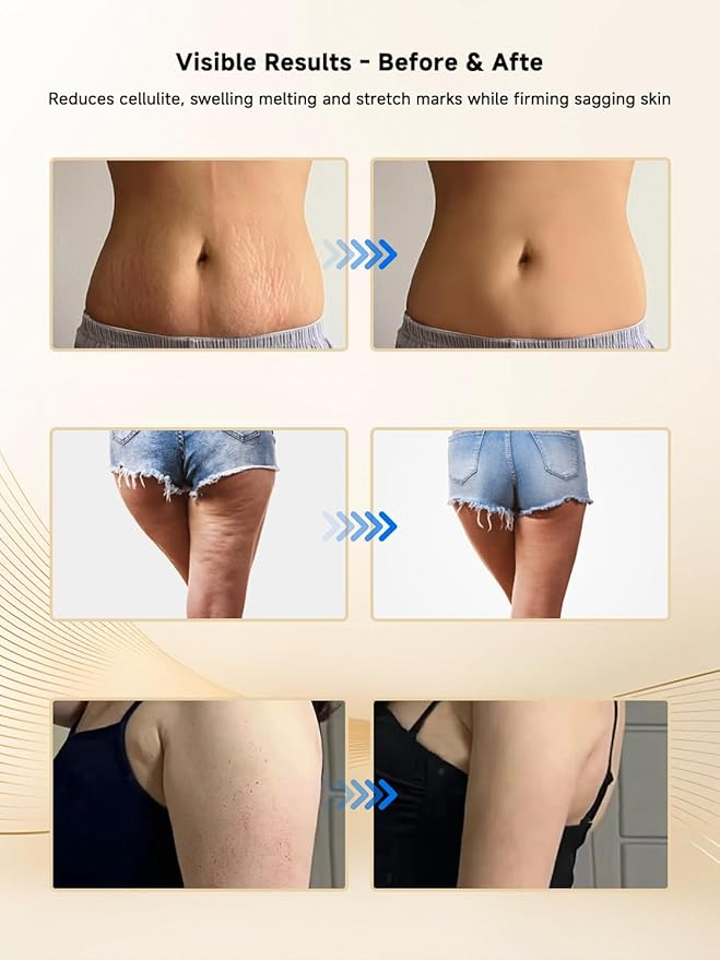 Lymphatic Drainage Massager, Electric Anti Cellulite Massage Tool, Helps Reduce Stretch Marks & Cellulite for Legs & Arms & Belly, Body Sculpting Machine with Microcurrent, Light, Heat & Vibration-Ruum Studio Home