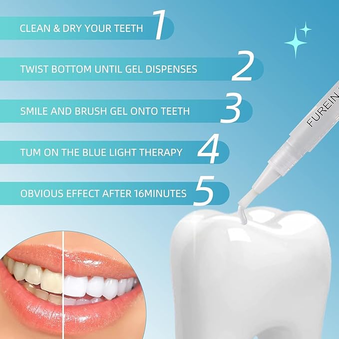 Teeth Whitening Pen 5 Pens 50+ Whitening Treatments -Removes Years of Stains 35% Carbamide Peroxide Tooth Whitener Brush Gel Pen-Ruum Studio Home