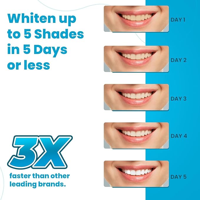 Advanced Teeth Whitening Strips – Pack of 10 (5 Treatments) - 5 Shades Brighter in 5 Days - Mint Flavored with Enamel Safe Comfort Fit Technology - Teeth Whitening Kit for Sensitive Teeth-Ruum Studio Home