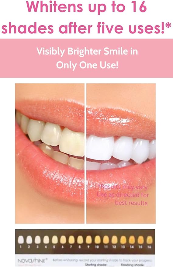 Novashine Professional Teeth Whitening Kit: Advanced Blue LED Light, Concentrated Peroxide Gel, Smartphone Adapter, Travel Bag-Ruum Studio Home