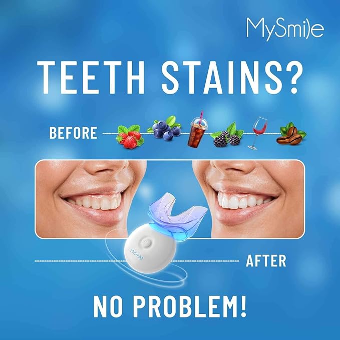 MySmile Teeth Whitening Kit with LED Light, 10 Min Non-Sensitive Fast Teeth Whitener with 3 Carbamide Peroxide Whitening Gel, Helps to Remove Stains from Coffee, Smoking, Wines, Soda, Food-Ruum Studio Home