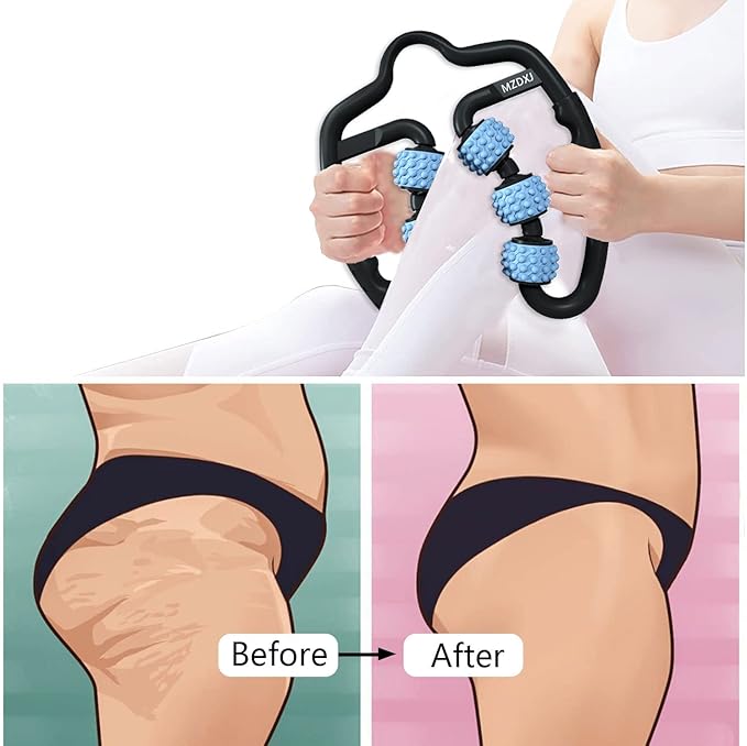 Cellulite Massage Tool Deep Fascia Massager & Dimpled Skin Remover for Legs - Anti-Cellulite Roller Tech with Lymphatic Drainage, Smooth Skin & Pain Relief for Thighs & Buttocks Sculpting-Ruum Studio Home
