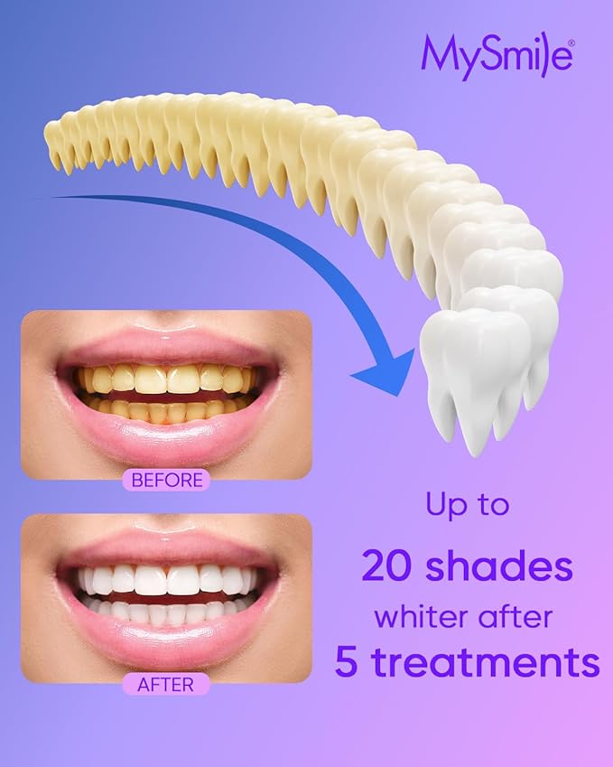 MySmile 4Pcs 35% Non-Sensitive Teeth Whitening Gel Refill Pack Kit for Whitening Teeth - Effective Painless Carbamide Peroxide Enamel Safety Mint Flavor Teeth Whitener(Not Include LED Mouth Tray)-Ruum Studio Home