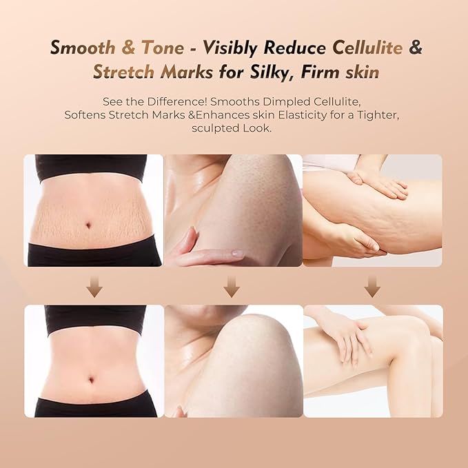 Microcurrent Lymphatic Drainage Massager for Legs Arms Belly, Body Sculpting Machine with Microcurrent, Cellulite Massage Tool,Light, Heat & Vibration, Promotes Circulation Skin Renewal-Ruum Studio Home