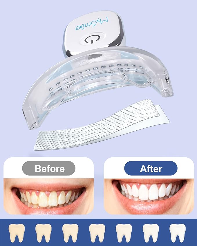 MySmile Teeth Whitening Strips Kit 14 Treatments with 28 LED Light - 10 Min Non-Sensitive Fast Whitening Teeth Enamel Safe Teeth Whitener - Helps to Remove Deep Stains-Ruum Studio Home