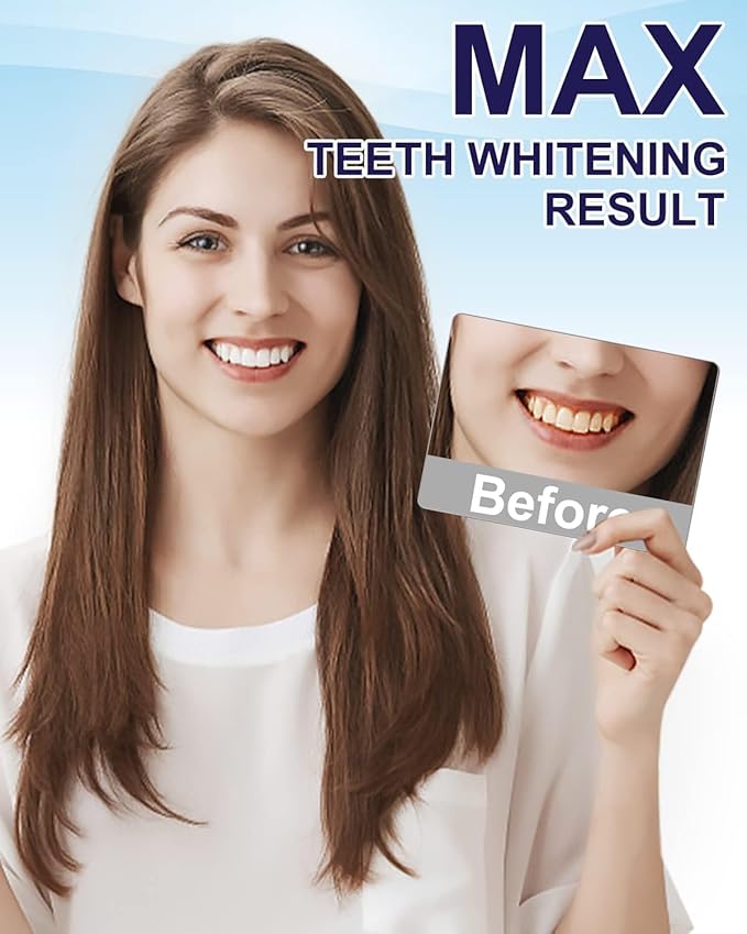MySmile Teeth Whitening Pen 30+ Treatment Enamel Safe Tooth Whitening Gel for Teeth Sensitive-10 Min Fast Whitening Teeth-Helps to Remove Stains from Coffee, Smoking, Wines-Mint Flavor-Ruum Studio Home