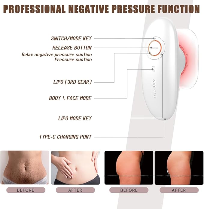 Thermoslim Body Sculpting Device - Triple-Action Sculpiflex Cellulite Device, Thermoslim Machine with Suction & Vibration for Thighs, Say Goodbye to Stubborn Cellulite-Ruum Studio Home