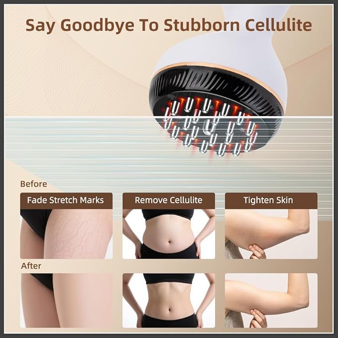 Lymphatic Drainage Massager, Cellulite Massage Tool Helps Reduce Stretch Marks & Cellulite Remover, for Belly, Legs, Arms, 30 Levels Microcurrent, Red Light, Heat and Vibration Body Engraving Machine-Ruum Studio Home