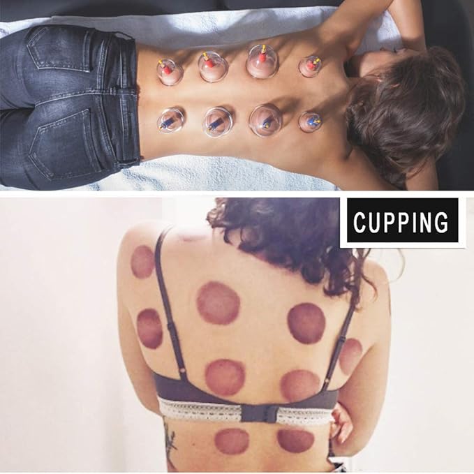 MUCHOO Cupping Set Professional Chinese Acupoint Cupping Therapy Sets Portable, Suction Hijama Cupping Set with Vacuum Magnetic Pump Cellulite Cupping Massage Kit 22-Cup-Ruum Studio Home