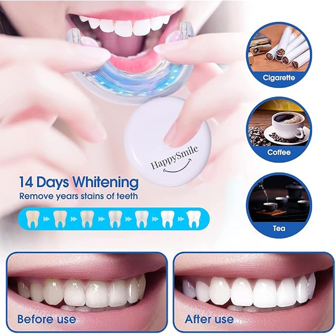HappySmile LED & Pen Teeth Whitening Kit - Professional Oral Care for White Teeth - Includes Teeth Whitening Pen & LED for a Brighten Your Smile - Premium Teeth Whitening kit-Ruum Studio Home