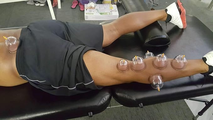 MUCHOO Cupping Set Professional Chinese Acupoint Cupping Therapy Sets Portable, Suction Hijama Cupping Set with Vacuum Magnetic Pump Cellulite Cupping Massage Kit 22-Cup-Ruum Studio Home