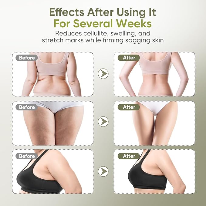 Lymphatic Drainage Massager & Anti Cellulite Massage Tool — Body Sculpting Machinefor Legs, Arms & Belly, Body,Helps Reduce Stretch Marks & Cellulite,with Microcurrent, Light Heat & Vibration-Ruum Studio Home