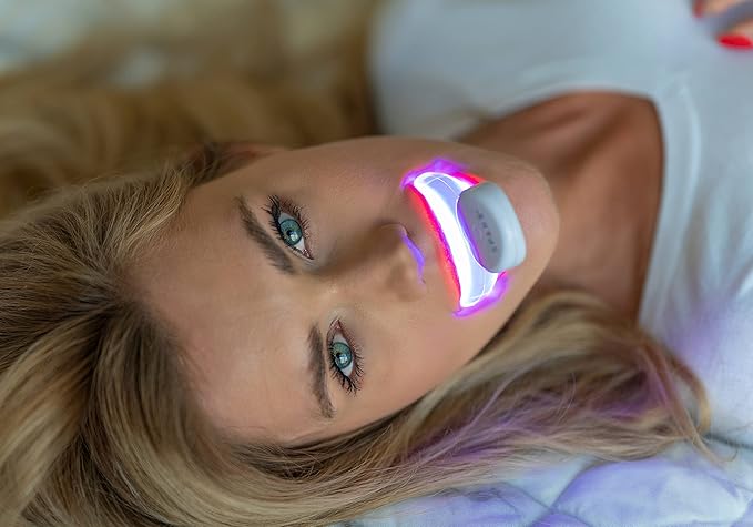 SPARX Wireless Teeth Whitening Kit with LED Light for Sensitive Teeth Remove Stains Like Coffee, Smoking, Wine. Whiten Smile for Long Lasting Results, Includes 3 Gel Syringes, 1 Dual LED Mouthpiece-Ruum Studio Home