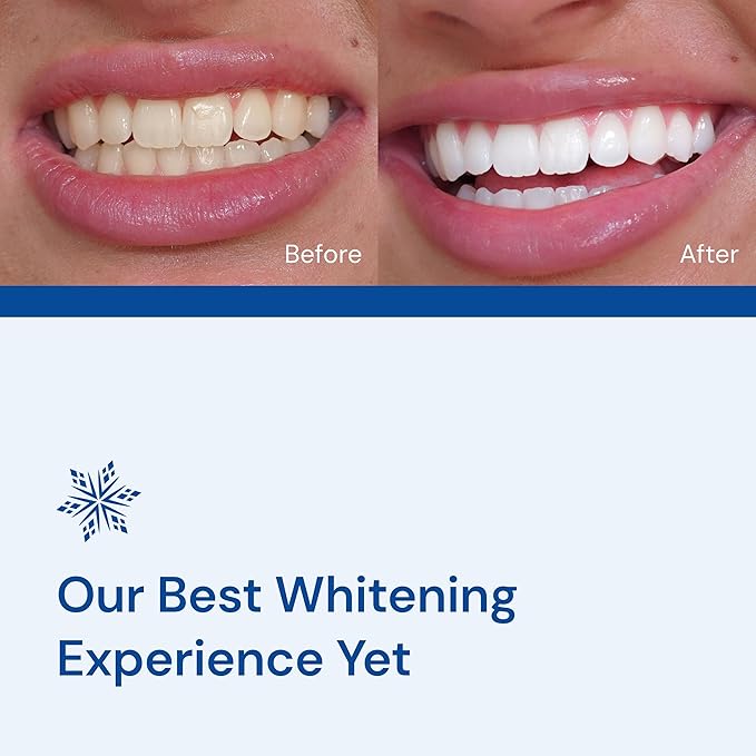 Snow Teeth Whitening Kit - Snow Teeth Whitening Serum and LED Mouthpiece Whitener, Formulated with Hydroxyapatite, Good for 2 Months - Wireless Kit with 1 Wand-Ruum Studio Home
