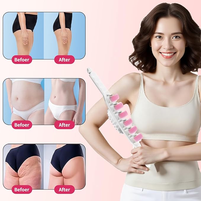 Docemel Cellulite Massage Tool for Legs,Thighs,and Arms–Lymphatic Drainage Massager for Pain Relief and Body Sculpting,Muscle Roller Stick for Circulation Support-Ruum Studio Home