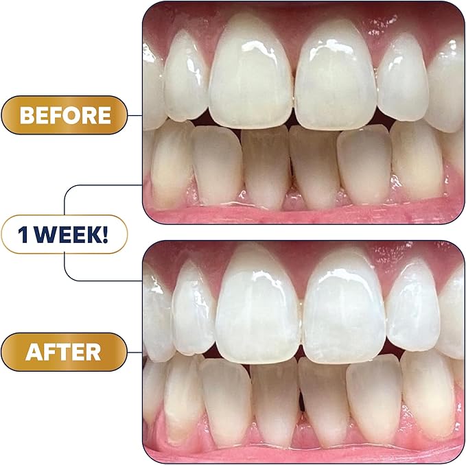 Lumineux Ultimate Whitening Kit Bundle - Contains Toothpaste, Mouthwash, Strips and Whitening Pen - Enamel Safe and Clinically Proven to Whiten Without The Sensitivity - Removes Coffee and Tea Stains-Ruum Studio Home
