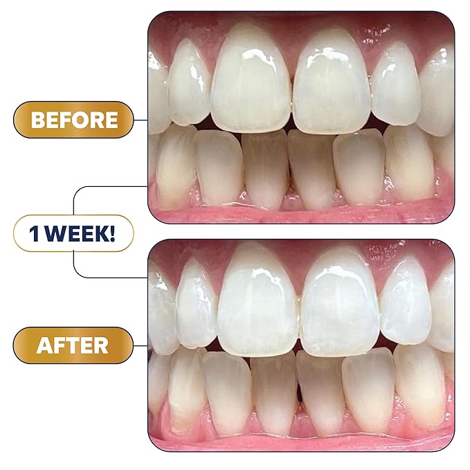 Lumineux 2-in-1 Whitening Pen (1 Pack) Enamel Safe and Clinically Proven to Whiten Without The Sensitivity - Removes Coffee, Tea, and Smoking Stains-Ruum Studio Home