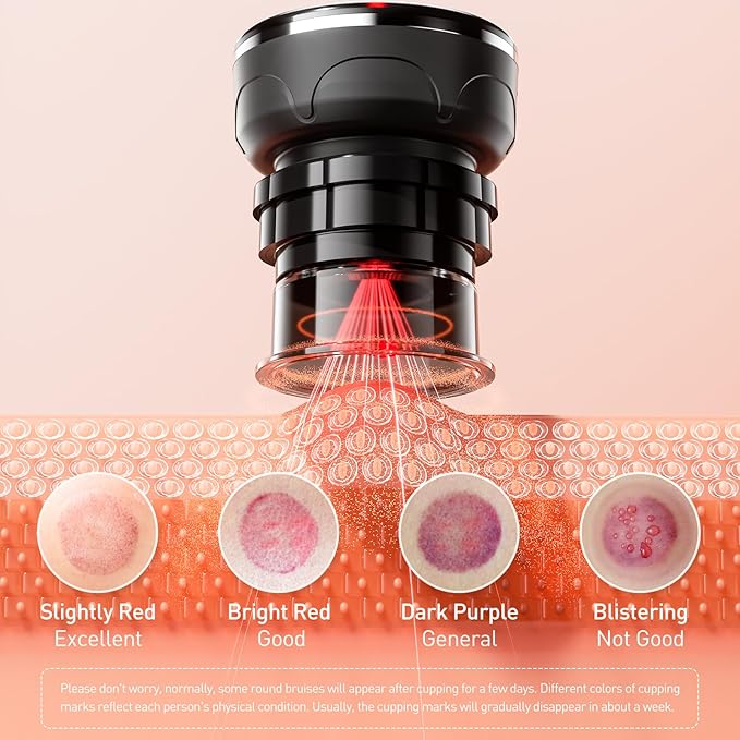 UBALANCE Smart Cupping Therapy Set - Cellulite Massager with 6 Massage Cups, Portable Electric Device for Enhanced Blood Circulation, Reduced Cellulite, and Muscle Soreness Relief(Black)-Ruum Studio Home