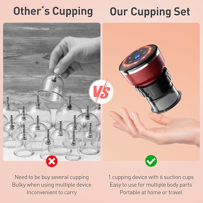 UBALANCE Smart Cupping Therapy Set - Cellulite Massager with 6 Massage Cups, Portable Electric Device for Enhanced Blood Circulation, Reduced Cellulite, and Muscle Soreness Relief（Red）-Ruum Studio Home