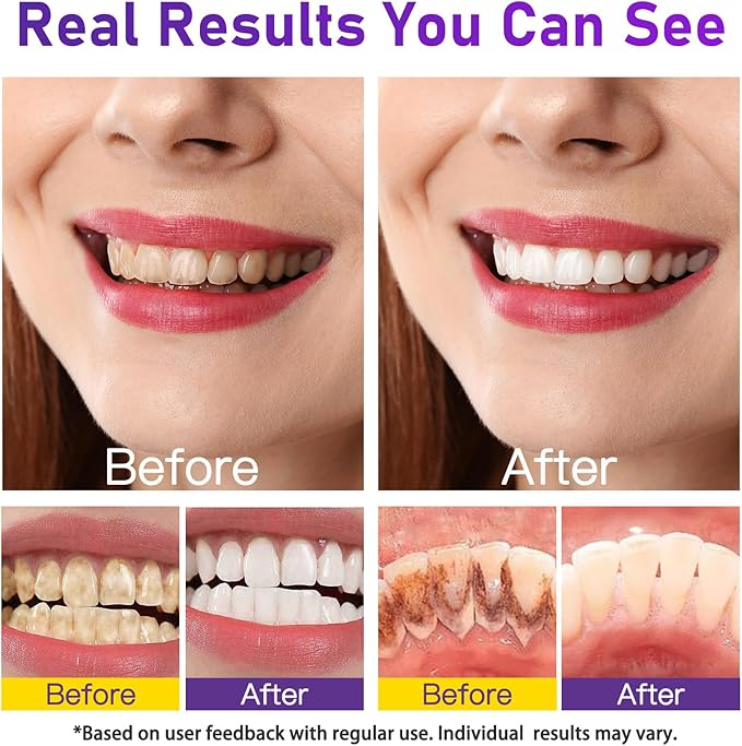 Teeth Whitening Powder - Teeth Whitening - Removes Stains - No Sensitivity - Toothpaste Power - Breath Freshener - for Coffee, Tea and Tobacco Stains 15g-Ruum Studio Home