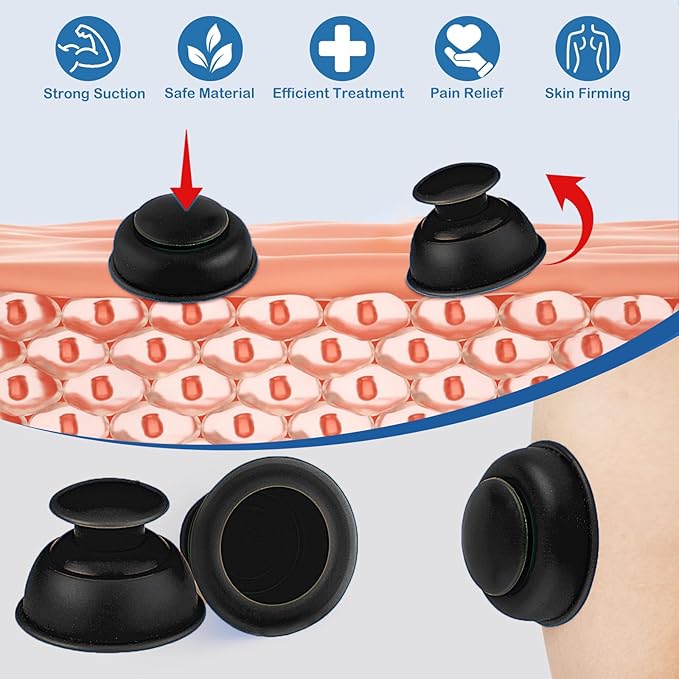Silicone Cupping Therapy Sets 10pcs,Professional Vacuum Cupping for Myofascial Massage/Joint Pain/Anti Cellulite/Deep Muscle Relief & More(10pcs,Black+White)-Ruum Studio Home