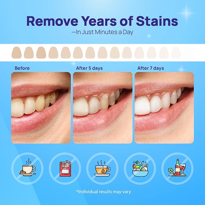Whitebite Pro Upgraded Teeth Whitening Strips 28 Strips (14 Treatments) | Enamel-Safe | Deep Stains Removal | Non-Slip Design | Whitening Without Any Harm | Mint-Ruum Studio Home