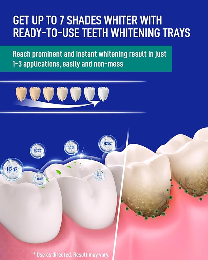 MySmile 7 Treatment Prefilled Teeth Whitening Trays 12% Hydrogen Peroxide and Fluoride Free Nano Hydroxyapatite Toothpaste Combo for Sensitive Teeth Relief, Enamel Repair and Teeth Remineralization-Ruum Studio Home