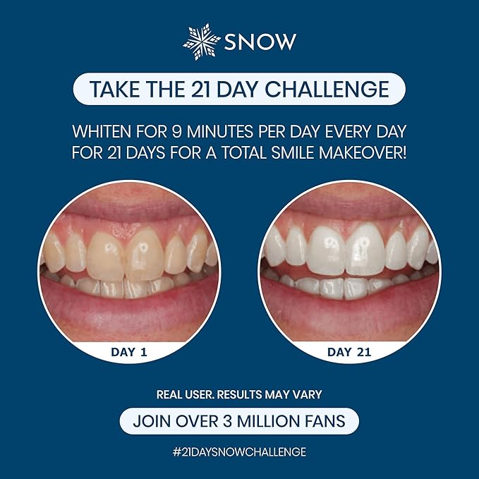 Snow Teeth Whitening Kit - Snow Teeth Whitening Serum and LED Mouthpiece Whitener, Formulated with Hydroxyapatite, Good for 6 Months - Wired Kit with 3 Wands-Ruum Studio Home
