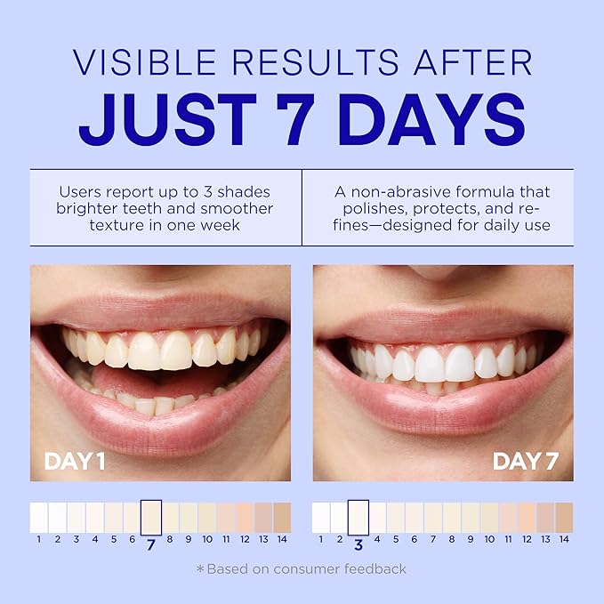 PearlSmile Niacinamide Hydroxyapatite Whitening Toothpaste – 10% Nano Hydroxyapatite + 5% Niacinamide – Strengthens Enamel, Remineralizes, Brightens Teeth – Fluoride-Free, Travel Size, 4.2oz (120g)-Ruum Studio Home