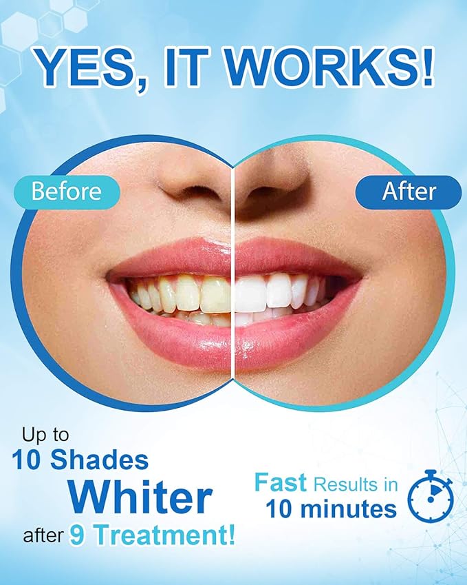 MySmile Non-Sensitive Teeth Whitening Pen Mint Gel Enamel Safety 8ML 30+ Treatments Fast Remove 20 Years of Stains Care Oral Bright Smile Alternative Teeth Whitening Strips ﻿-Ruum Studio Home