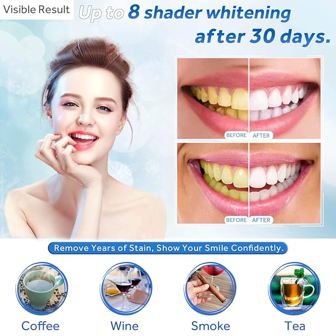 EZGO 10 Pack Teeth Whitening Gel Refills 22% Bleaching Gel, No Sensitive Teeth Whitener, Great for Sensitive Tooth Whitening, Carbamide Peroxide Teeth Whitening Gel, Mint Flavor (10X 3ML)-Ruum Studio Home