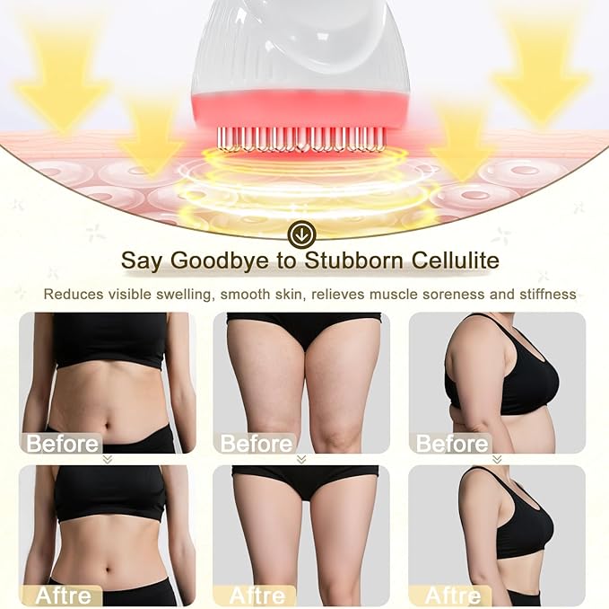 2025 Upgraded Lymphatic Drainage Massager Body Sculpting Machine Helps Reduce Stretch Marks & Cellulite for Legs, Arms & Belly Anti Cellulite Massage Tool with Light Heat & Vibration-Ruum Studio Home