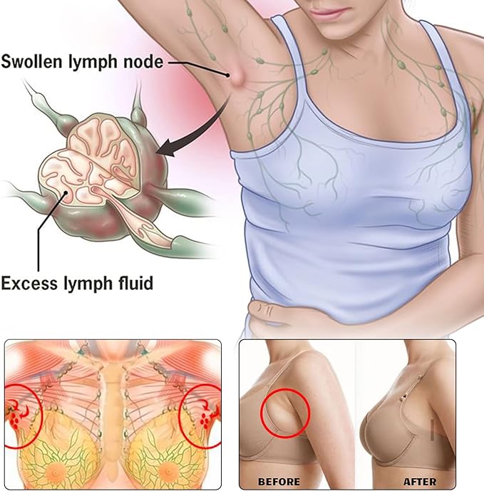 BXQJRJLymphatic Drainage Patch Lymphatic Drainage Herbal Lymphatic Drainage Care Patch Herbal Neck Patch (12)-Ruum Studio Home