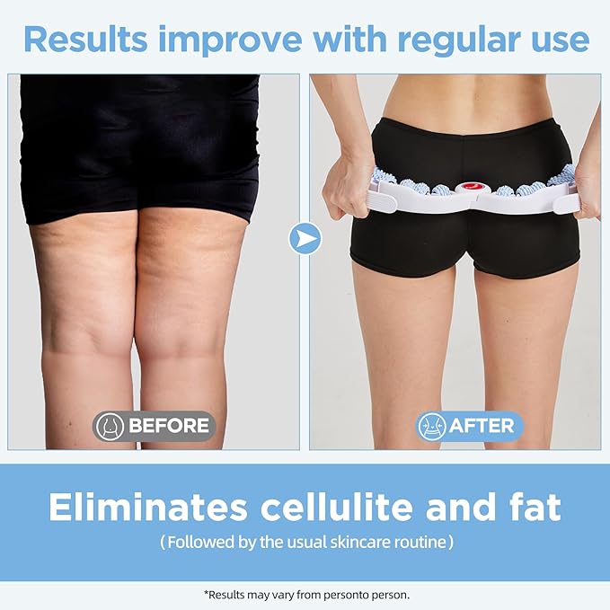 Cellulite Massage Tool Deep Fascia Massager & Dimpled Skin Remover for Legs - Anti-Cellulite Roller Tech with Lymphatic Drainage, Smooth Skin & Pain Relief for Thighs & Buttocks Sculpting-Ruum Studio Home