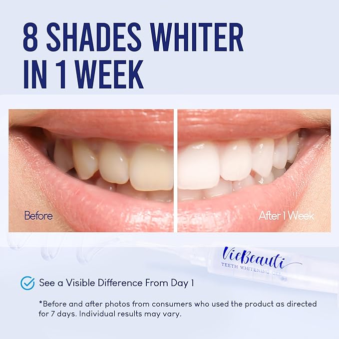 VieBeauti Teeth Whitening Kit with LED Light for Sensitive Teeth, 35% Carbamide Peroxide, Remineralizing Gel for Fast Results Mint-Ruum Studio Home